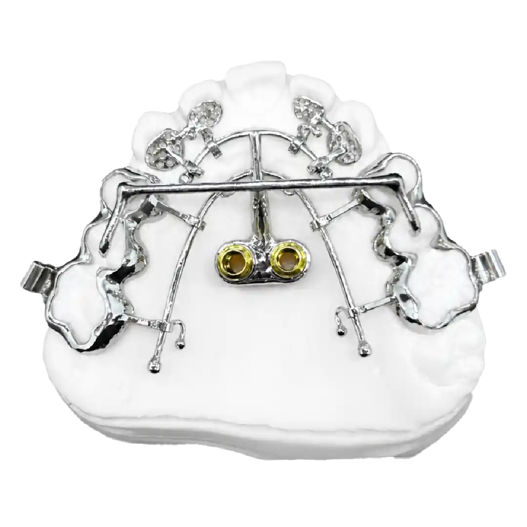 Reverse Palatal System